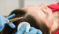 Мезотерапия волос и лица: что это и кому нужна? 
