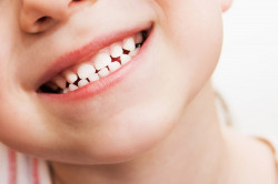 Как обеспечить здоровье зубов у детей: советы для укрепления зубной эмали